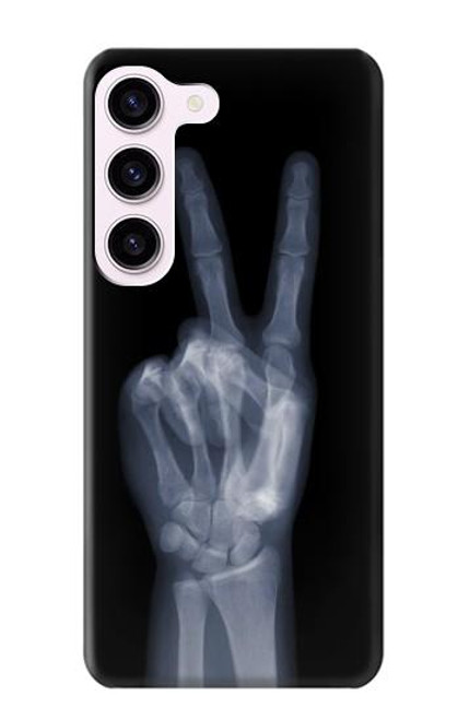 W3101 X-ray Peace Sign Fingers Hard Case and Leather Flip Case For Samsung Galaxy S23