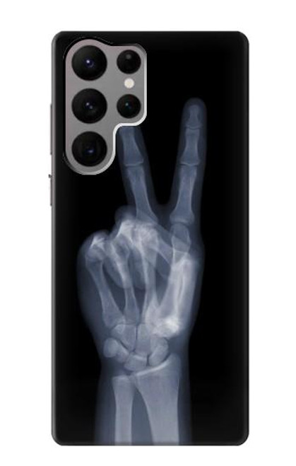 W3101 X-ray Peace Sign Fingers Hard Case and Leather Flip Case For Samsung Galaxy S23 Ultra