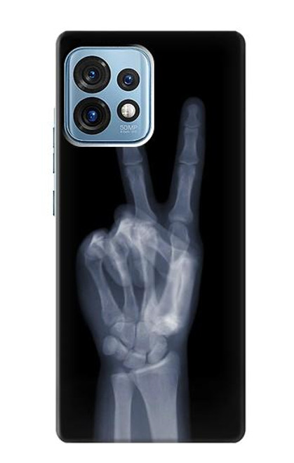 W3101 X-ray Peace Sign Fingers Hard Case and Leather Flip Case For Motorola Edge+ (2023), X40, X40 Pro, Edge 40 Pro