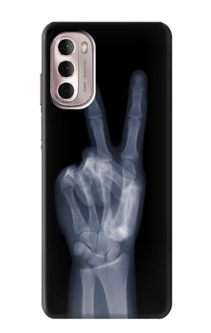 W3101 X-ray Peace Sign Fingers Hard Case and Leather Flip Case For Motorola Moto G Stylus 4G (2022)