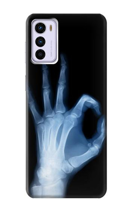 W3239 X-Ray Hand Sign OK Hard Case and Leather Flip Case For Motorola Moto G42