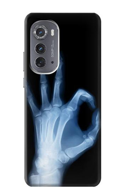 W3239 X-Ray Hand Sign OK Hard Case and Leather Flip Case For Motorola Edge (2022)