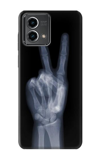 W3101 X-ray Peace Sign Fingers Hard Case and Leather Flip Case For Motorola Moto G Stylus 5G (2023)