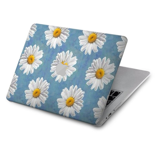 W3454 Floral Daisy Hard Case Cover For MacBook Air 15″ (2023,2024) - A2941, A3114