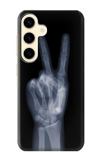 W3101 X-ray Peace Sign Fingers Hard Case and Leather Flip Case For Samsung Galaxy S24