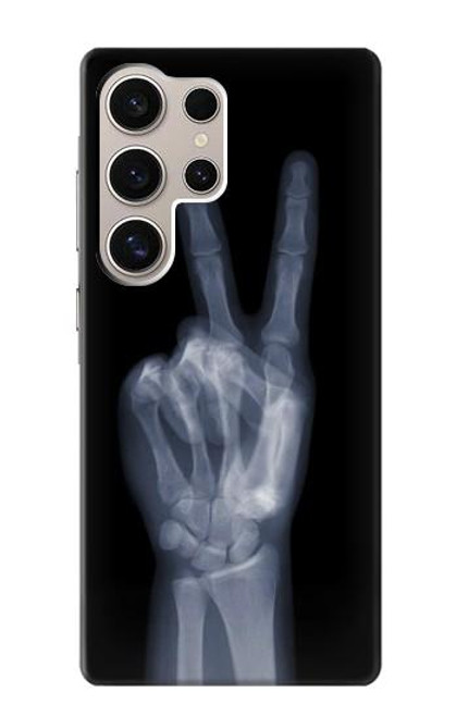 W3101 X-ray Peace Sign Fingers Hard Case and Leather Flip Case For Samsung Galaxy S24 Ultra