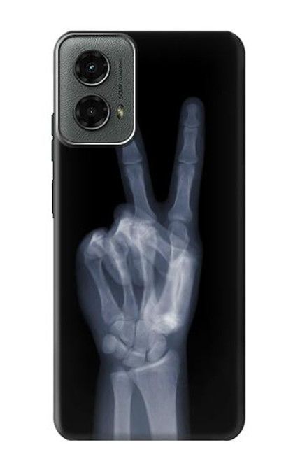 W3101 X-ray Peace Sign Fingers Hard Case and Leather Flip Case For Motorola Moto G 5G (2024)