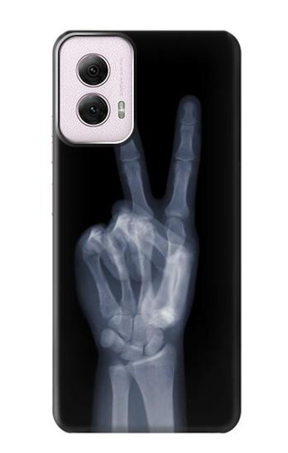 W3101 X-ray Peace Sign Fingers Hard Case and Leather Flip Case For Motorola Moto G Power 5G (2024)