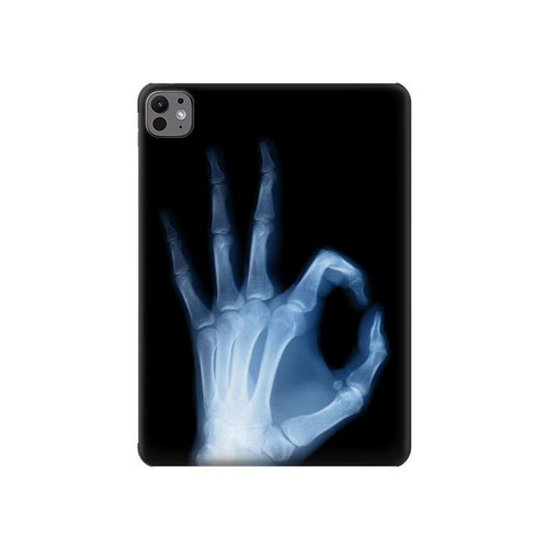 W3239 X-Ray Hand Sign OK Tablet Hard Case For iPad Pro 11 (2024)
