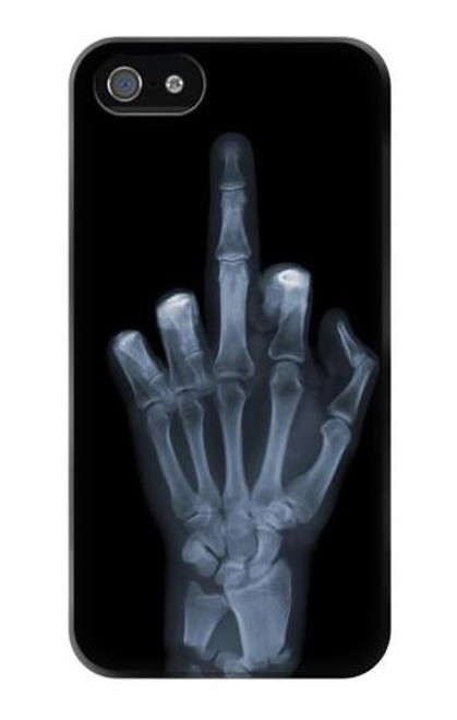 W1143 X-ray Hand Middle Finger Hard Case and Leather Flip Case For iPhone 4 4S