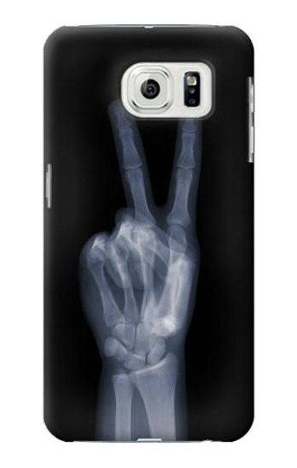 W3101 X-ray Peace Sign Fingers Hard Case and Leather Flip Case For Samsung Galaxy S7 Edge