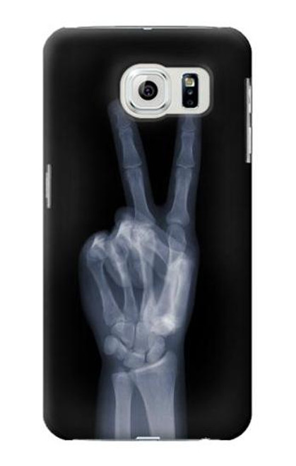 W3101 X-ray Peace Sign Fingers Hard Case and Leather Flip Case For Samsung Galaxy S6 Edge