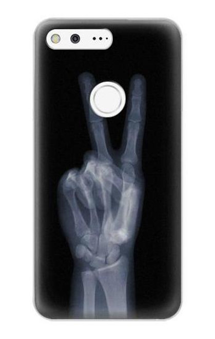 W3101 X-ray Peace Sign Fingers Hard Case and Leather Flip Case For Google Pixel XL