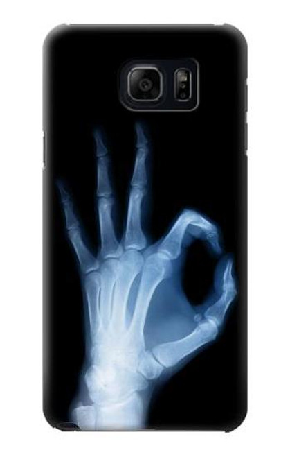 W3239 X-Ray Hand Sign OK Hard Case and Leather Flip Case For Samsung Galaxy S6 Edge Plus