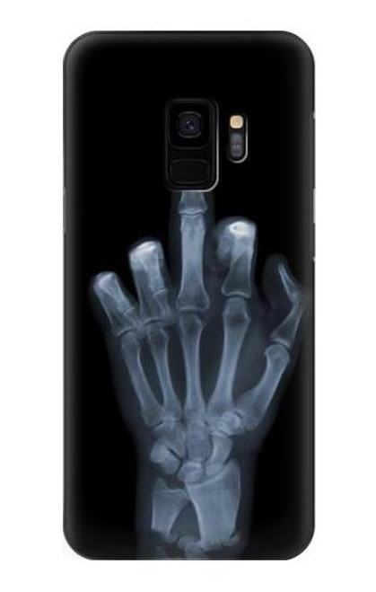 W1143 X-ray Hand Middle Finger Hard Case and Leather Flip Case For Samsung Galaxy S9