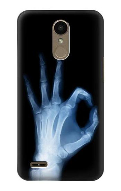 W3239 X-Ray Hand Sign OK Hard Case and Leather Flip Case For LG K10 (2018), LG K30