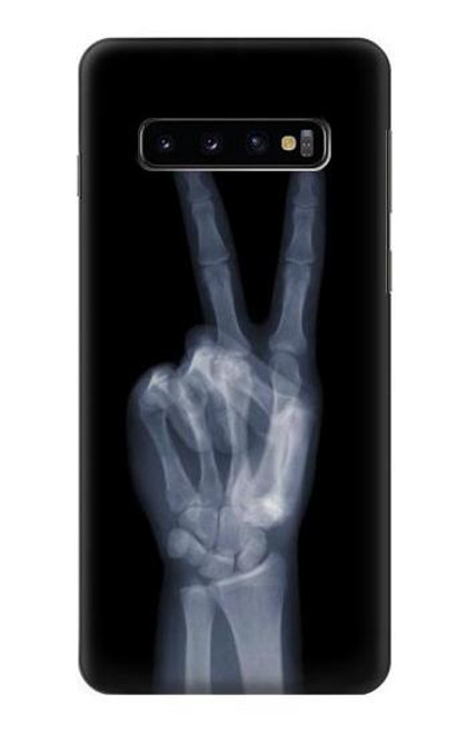 W3101 X-ray Peace Sign Fingers Hard Case and Leather Flip Case For Samsung Galaxy S10