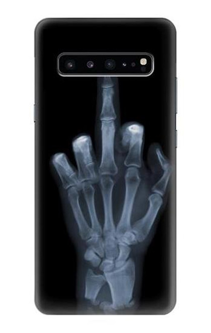 W1143 X-ray Hand Middle Finger Hard Case and Leather Flip Case For Samsung Galaxy S10 5G