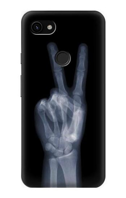 W3101 X-ray Peace Sign Fingers Hard Case and Leather Flip Case For Google Pixel 3a XL