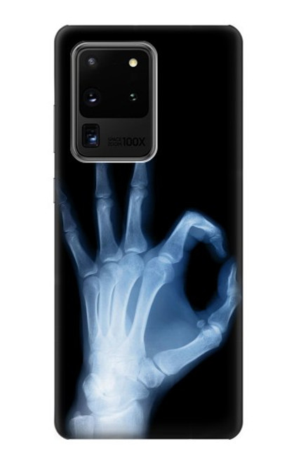 W3239 X-Ray Hand Sign OK Hard Case and Leather Flip Case For Samsung Galaxy S20 Ultra