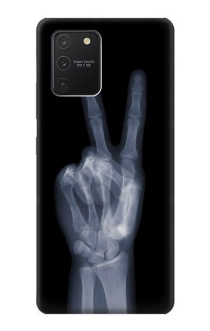 W3101 X-ray Peace Sign Fingers Hard Case and Leather Flip Case For Samsung Galaxy S10 Lite