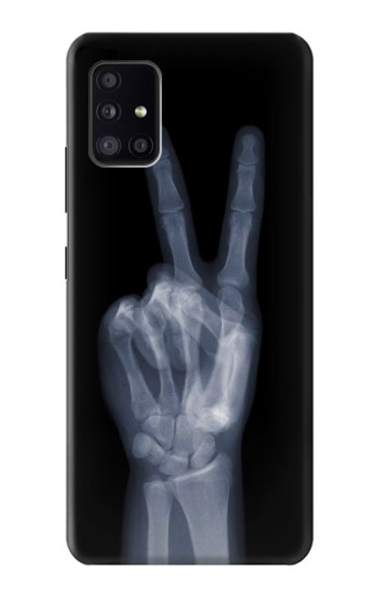 W3101 X-ray Peace Sign Fingers Hard Case and Leather Flip Case For Samsung Galaxy A41