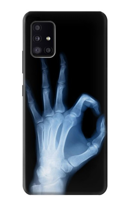 W3239 X-Ray Hand Sign OK Hard Case and Leather Flip Case For Samsung Galaxy A41