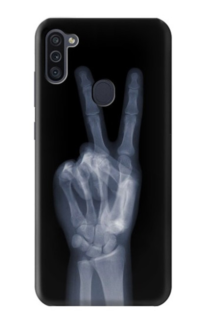 W3101 X-ray Peace Sign Fingers Hard Case and Leather Flip Case For Samsung Galaxy M11