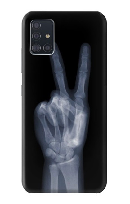 W3101 X-ray Peace Sign Fingers Hard Case and Leather Flip Case For Samsung Galaxy A51 5G [for A51 5G only. NOT for A51]