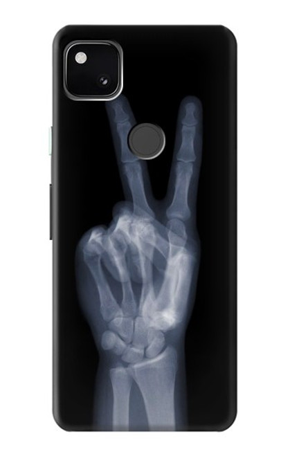 W3101 X-ray Peace Sign Fingers Hard Case and Leather Flip Case For Google Pixel 4a