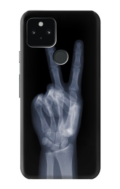 W3101 X-ray Peace Sign Fingers Hard Case and Leather Flip Case For Google Pixel 5