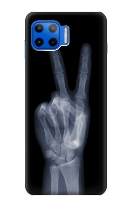 W3101 X-ray Peace Sign Fingers Hard Case and Leather Flip Case For Motorola Moto G 5G Plus