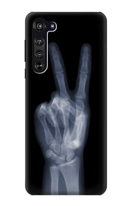 W3101 X-ray Peace Sign Fingers Hard Case and Leather Flip Case For Motorola Edge