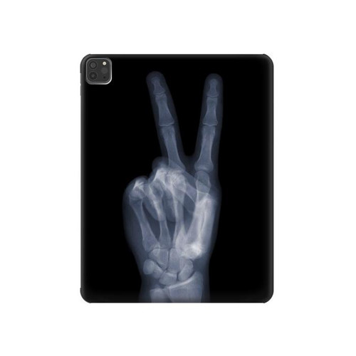 W3101 X-ray Peace Sign Fingers Tablet Hard Case For iPad Pro 11 (2021,2020,2018, 3rd, 2nd, 1st)