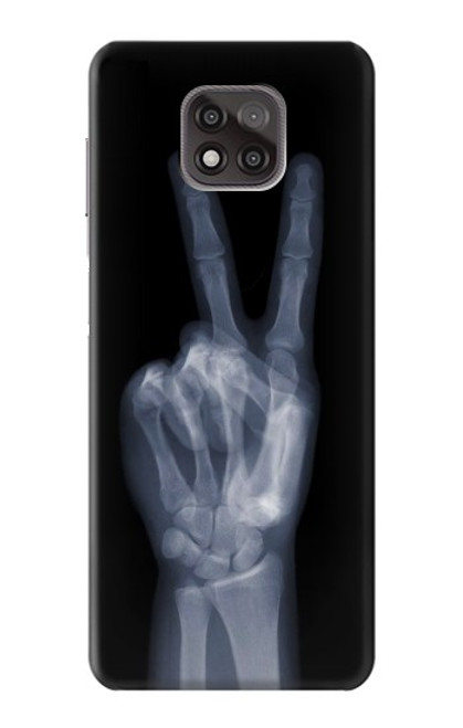 W3101 X-ray Peace Sign Fingers Hard Case and Leather Flip Case For Motorola Moto G Power (2021)