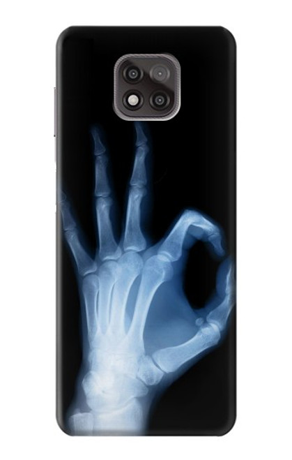 W3239 X-Ray Hand Sign OK Hard Case and Leather Flip Case For Motorola Moto G Power (2021)