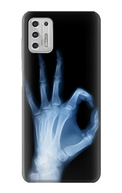 W3239 X-Ray Hand Sign OK Hard Case and Leather Flip Case For Motorola Moto G Stylus (2021)