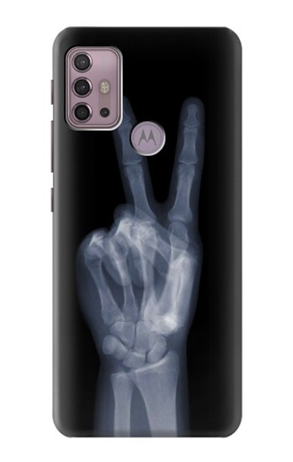 W3101 X-ray Peace Sign Fingers Hard Case and Leather Flip Case For Motorola Moto G30, G20, G10