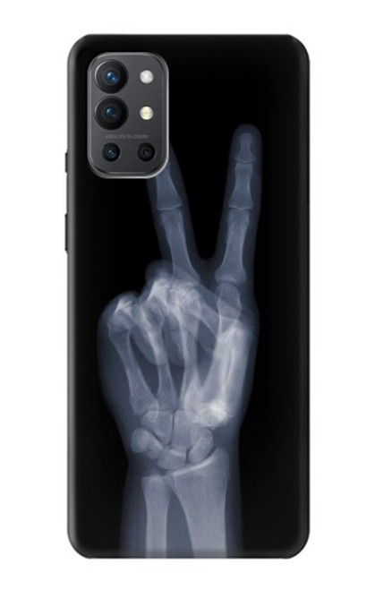 W3101 X-ray Peace Sign Fingers Hard Case and Leather Flip Case For OnePlus 9R