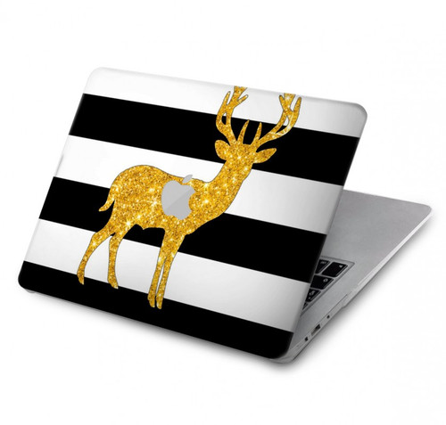 W2794 Black and White Striped Deer Gold Sparkles Hard Case Cover For MacBook Air 13″ - A1932, A2179, A2337