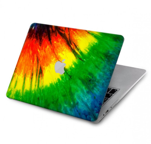 W3422 Tie Dye Hard Case Cover For MacBook Air 13″ - A1932, A2179, A2337