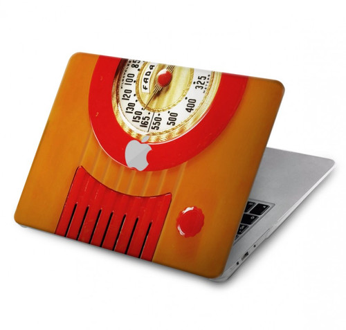 W2780 Vintage Orange Bakelite Radio Hard Case Cover For MacBook Pro 13″ - A1706, A1708, A1989, A2159, A2289, A2251, A2338