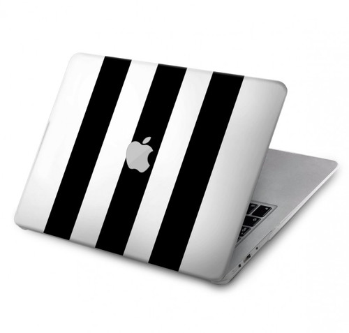 W2297 Black and White Vertical Stripes Hard Case Cover For MacBook Pro 15″ - A1707, A1990