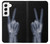 W3101 X-ray Peace Sign Fingers Hard Case and Leather Flip Case For Samsung Galaxy S22