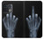 W1143 X-ray Hand Middle Finger Hard Case and Leather Flip Case For OnePlus 10 Pro