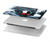W0297 Zombie Dead Man Hard Case Cover For MacBook Pro 14 M1,M2,M3 (2021,2023) - A2442, A2779, A2992, A2918