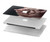 W1273 Crazy Pig Hard Case Cover For MacBook Pro 14 M1,M2,M3 (2021,2023) - A2442, A2779, A2992, A2918