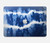 W3671 Blue Tie Dye Hard Case Cover For MacBook Pro 14 M1,M2,M3 (2021,2023) - A2442, A2779, A2992, A2918