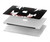 W3527 Vampire Teeth Bloodstain Hard Case Cover For MacBook Pro 16 M1,M2 (2021,2023) - A2485, A2780