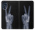 W3101 X-ray Peace Sign Fingers Hard Case and Leather Flip Case For Motorola Moto G (2022)